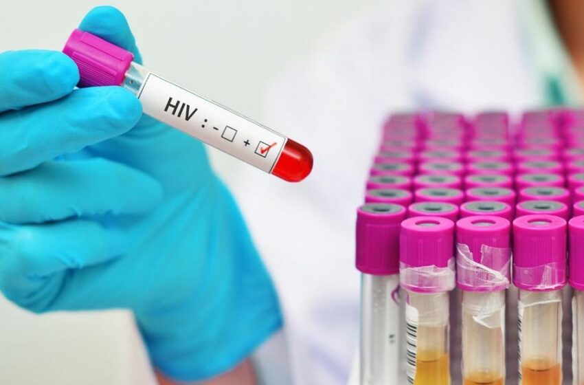  VB variant: Highly Virulent HIV Strain Found in the Netherlands