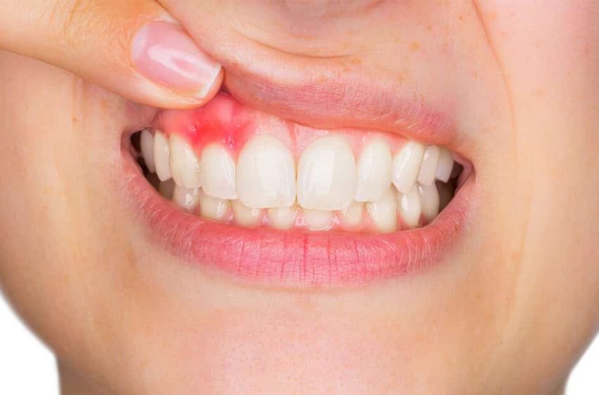  Why Do My Teeth Feel loose?