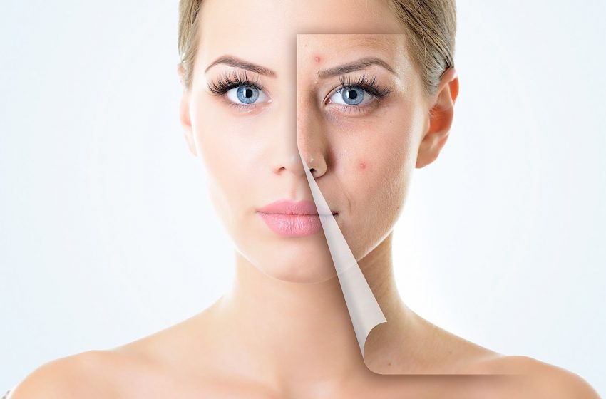  5 Proven Benefits of Botox