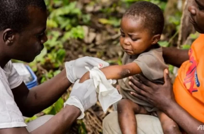  Are We Prepared for Mass Vaccination for Monkeypox Outbreak?