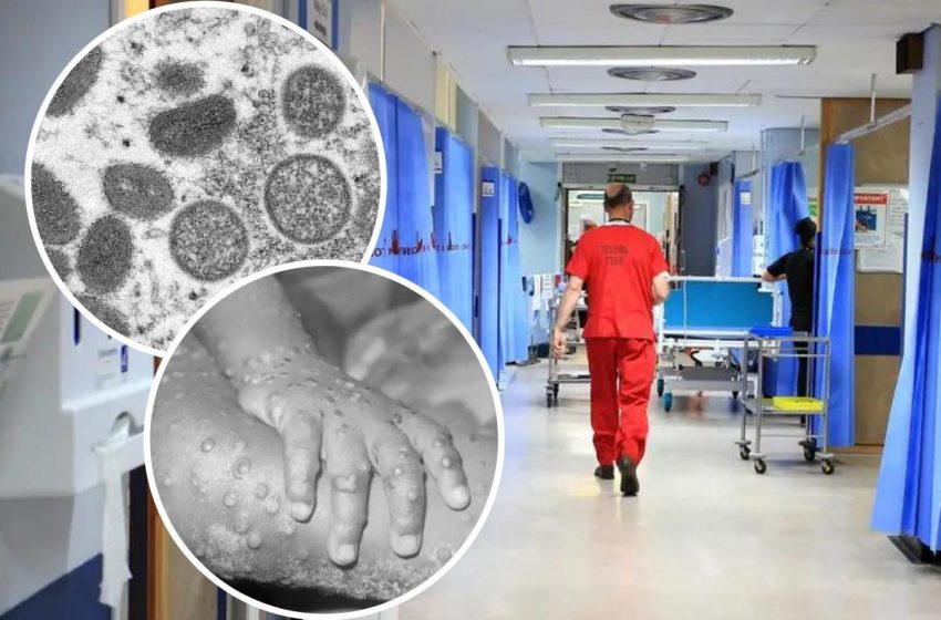  Monkeypox Cases on Rise in UK