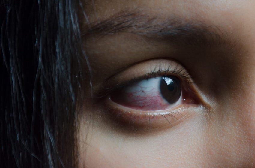  7 Reason Why Does Weed Make Your Eyes Red