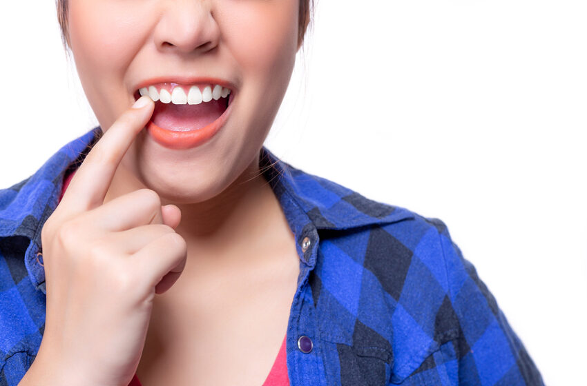  Bad breath and swelling are the main symptoms of Gingivitis.